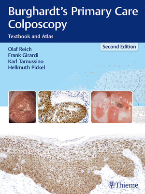 cover image of Burghardt's Primary Care Colposcopy